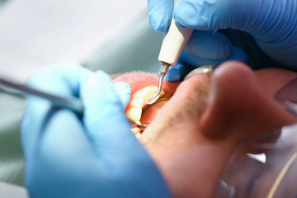 Best Dentist Open Late Near Me  in Rutgers University Livingston Campus, NJ