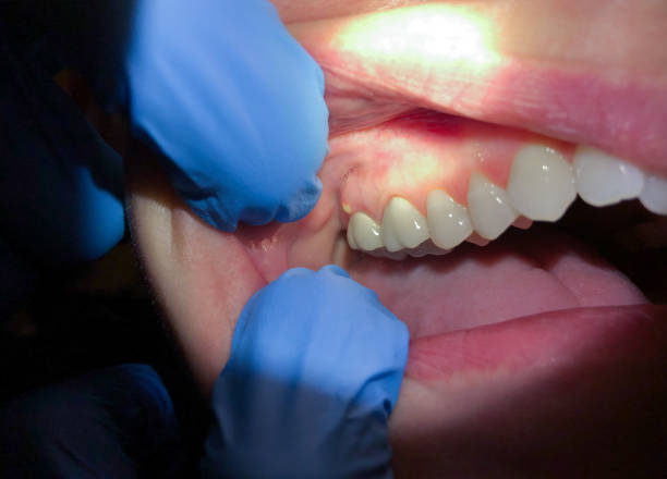 Best Affordable Emergency Dental Care  in Rutgers University Livingston Campus, NJ