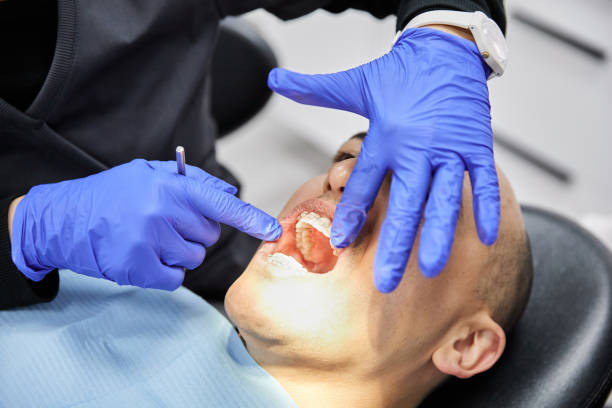 Best Broken Tooth Emergency  in Rutgers University Livingston Campus, NJ