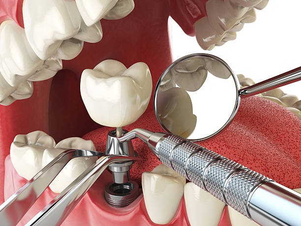 Best Urgent Dental Care  in Rutgers University Livingston Campus, NJ